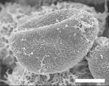 The Mechanism of Fungus Inactivation by nanoe™ Technology Partially Clarified