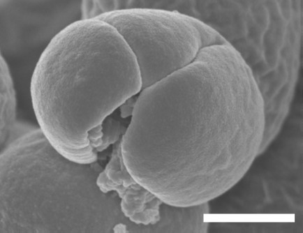 The Mechanism of Fungus Inactivation by nanoe™ Technology Partially Clarified