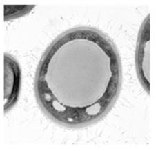 The Mechanism of Fungus Inactivation by nanoe™ Technology Partially Clarified