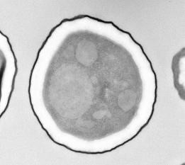 The Mechanism of Fungus Inactivation by nanoe™ Technology Partially Clarified