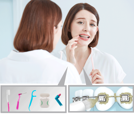 Îngrijirea bucală este adesea o provocare pentru pacienții cu lucrări ortodontice